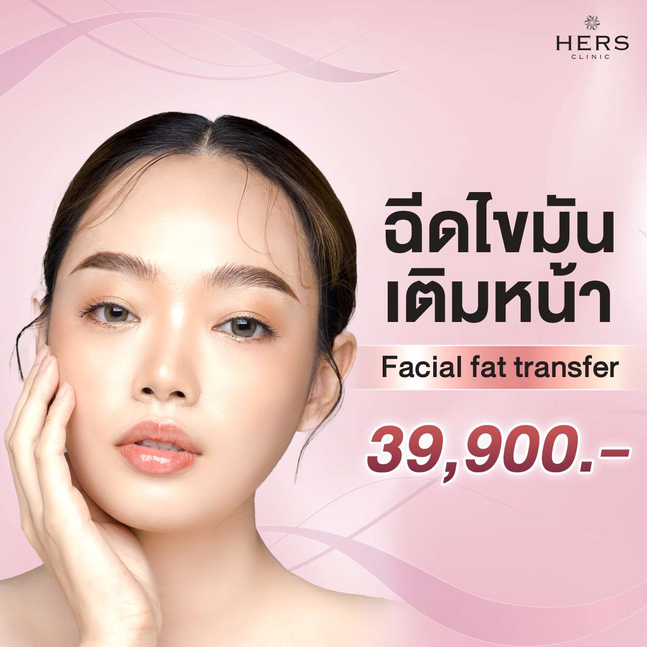 Facial fat transfer