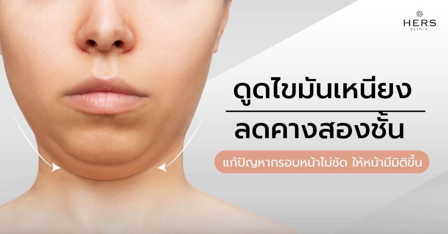 ดูดไขมันเหนียง ลดคางสองชั้น แก้ปัญหากรอบหน้าไม่ชัด ให้หน้ามีมิติขึ้น