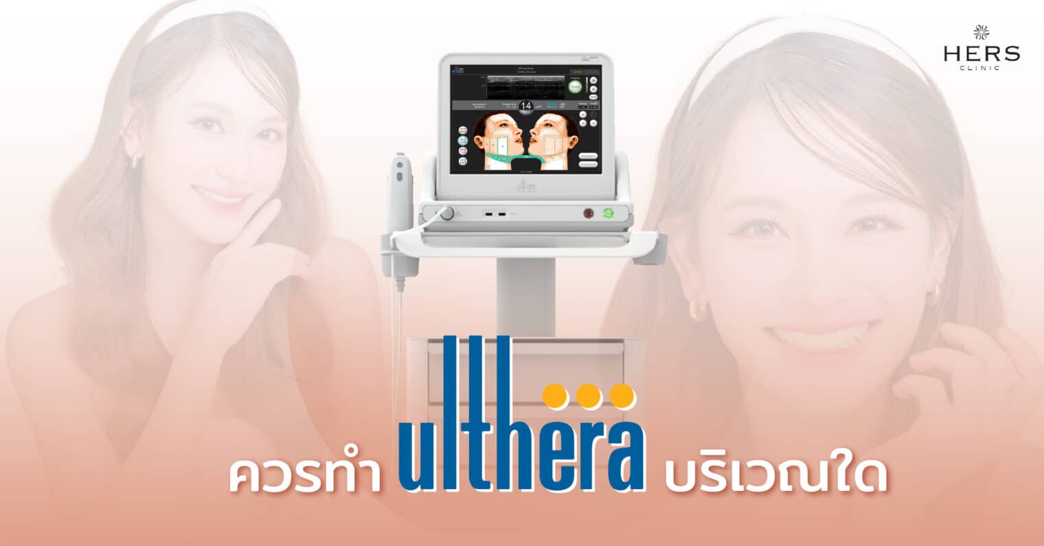 ควรทำ Ulthera บริเวณใด