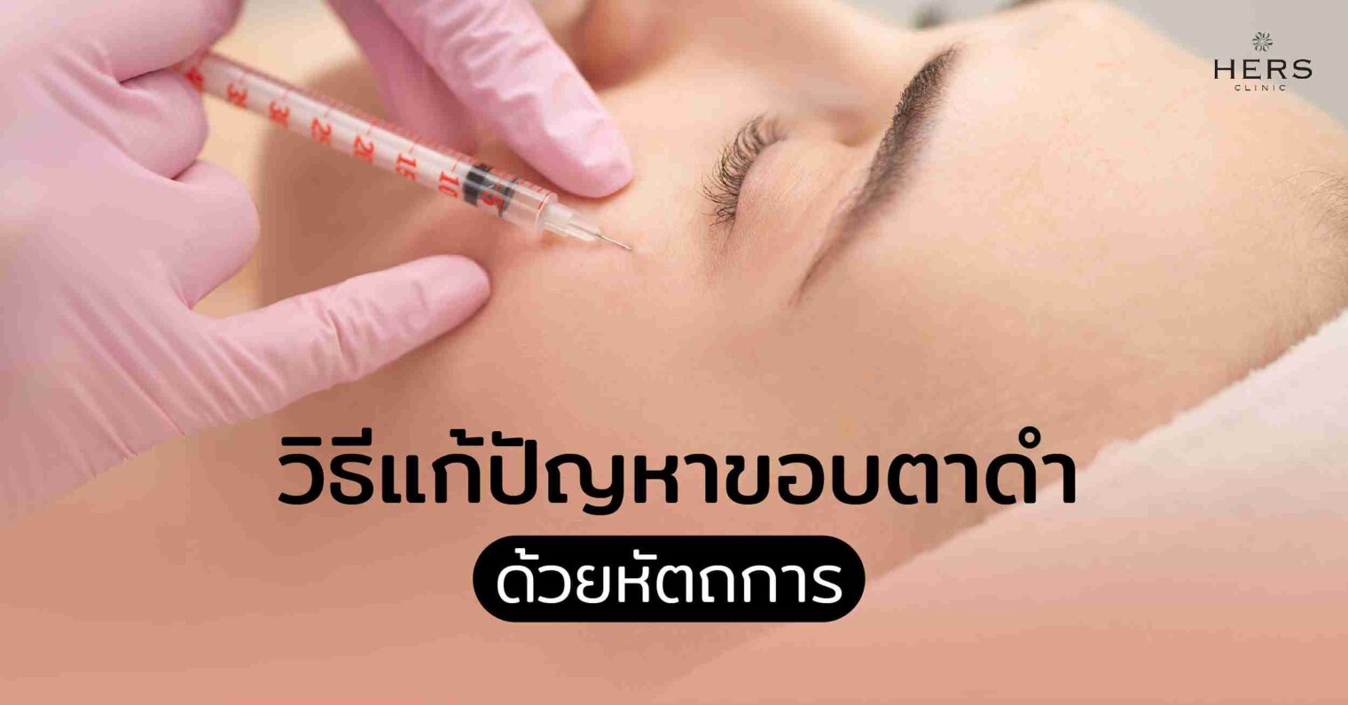 วิธีแก้ปัญหาขอบตาดำ ด้วยหัตถการ