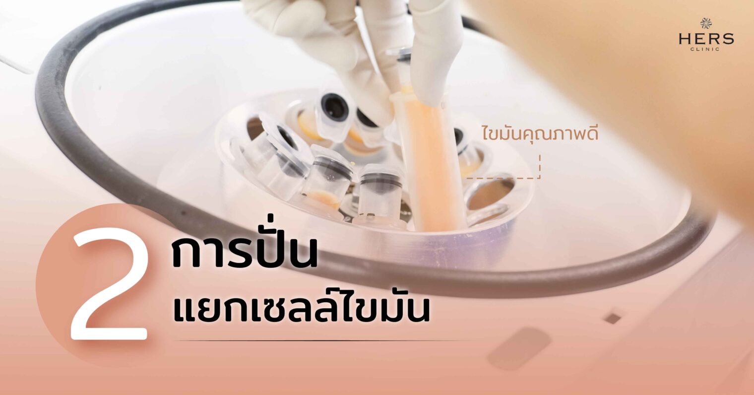การปั่นแยกเซลล์ไขมัน
