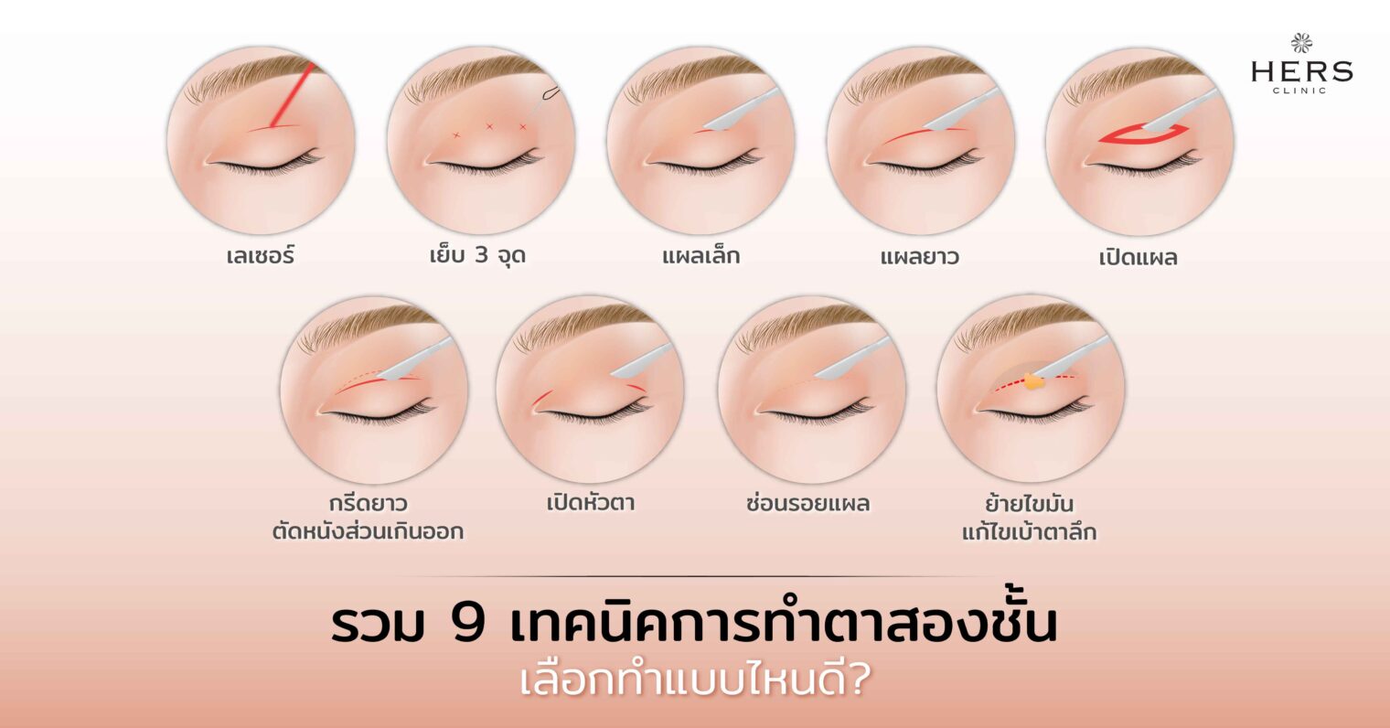 รวม 9 เทคนิคการทำตาสองชั้น เลือกทำแบบไหนดี?
