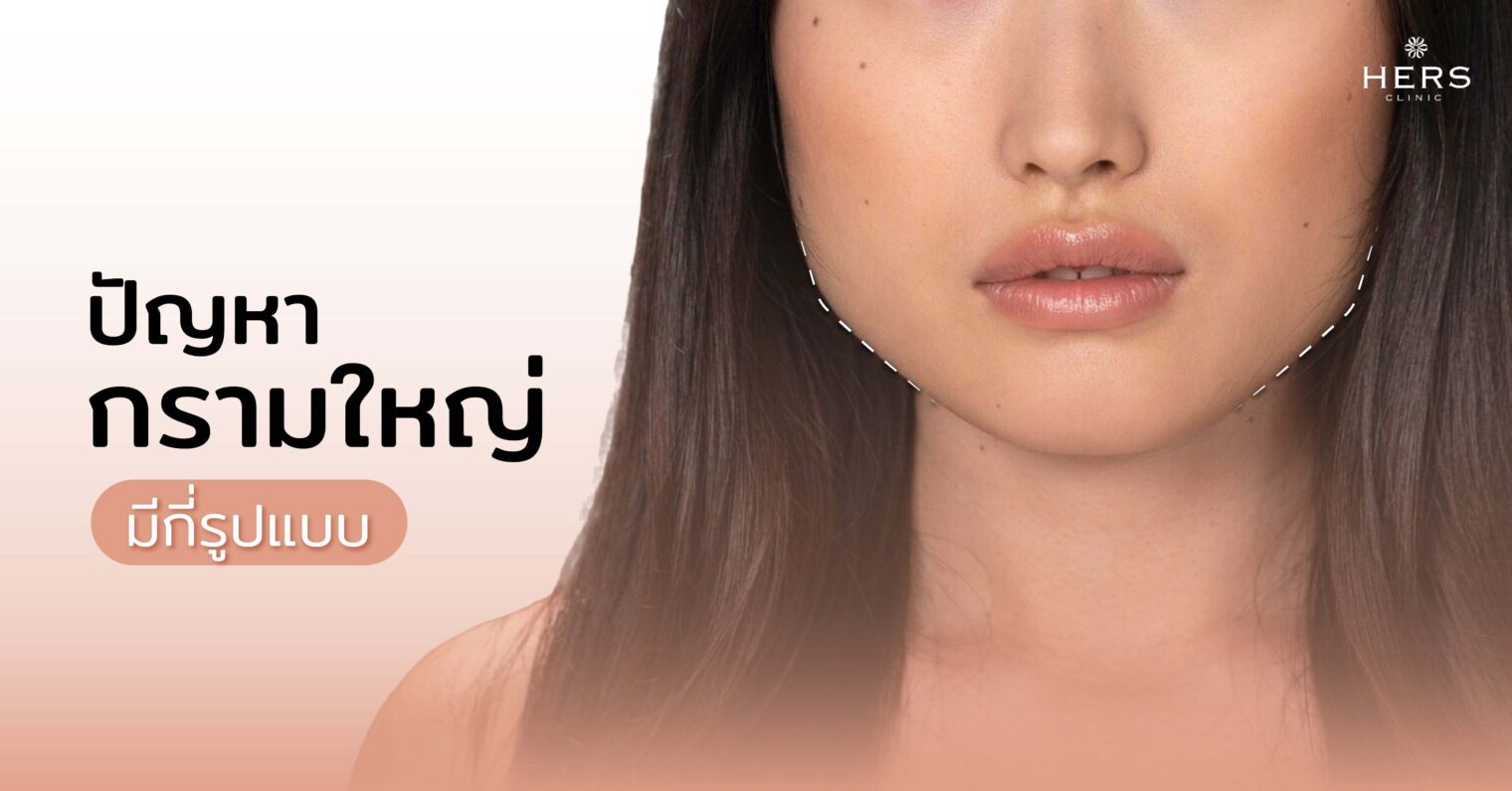 ปัญหากรามใหญ่ มีกี่รูปแบบ