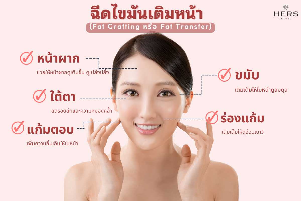 บริเวณที่ ฉีดไขมันเติมหน้า