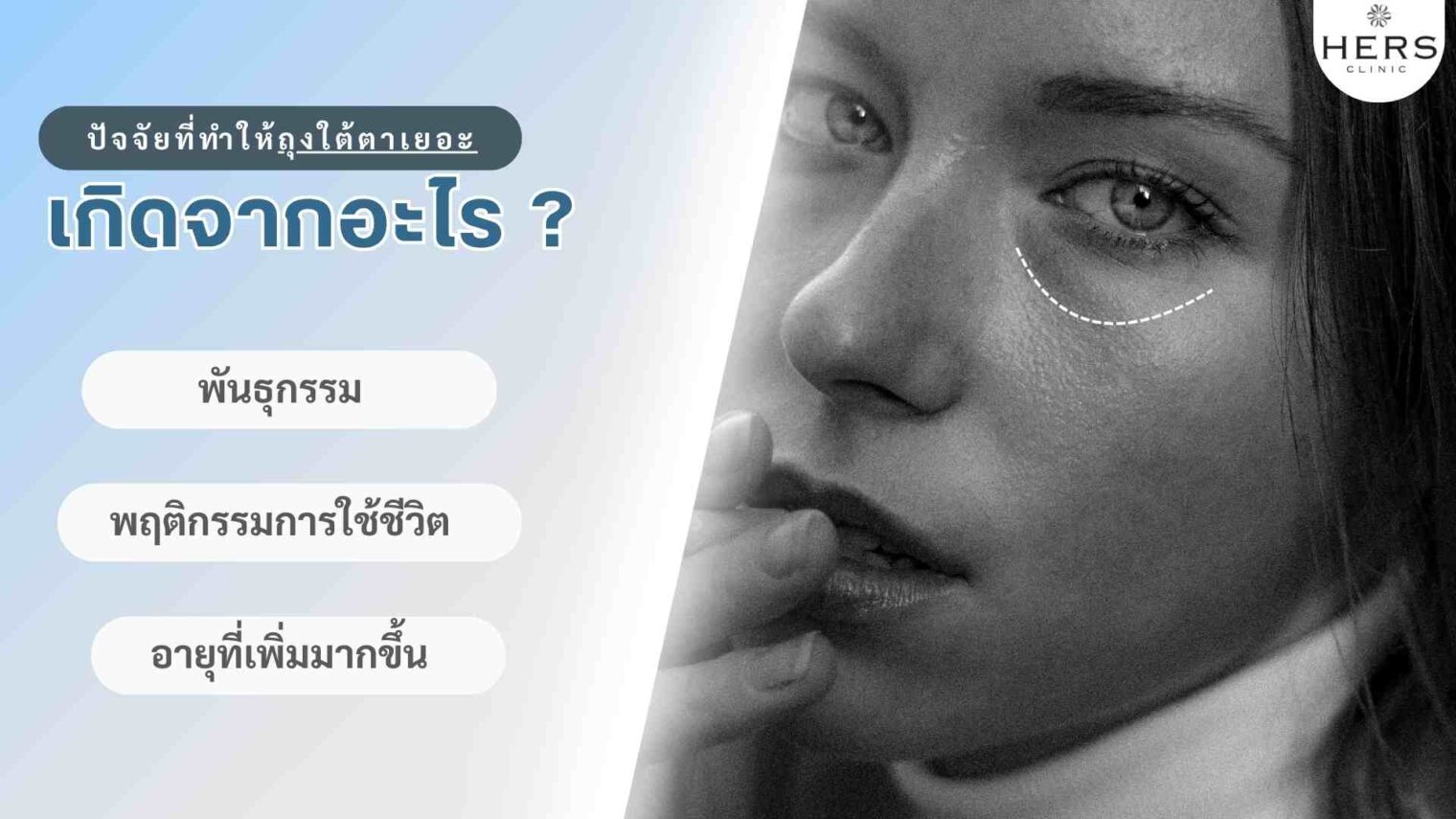 ปัจจัยที่ทำให้เกิดถุงใต้ตาเยอะ ใต้ตานูน