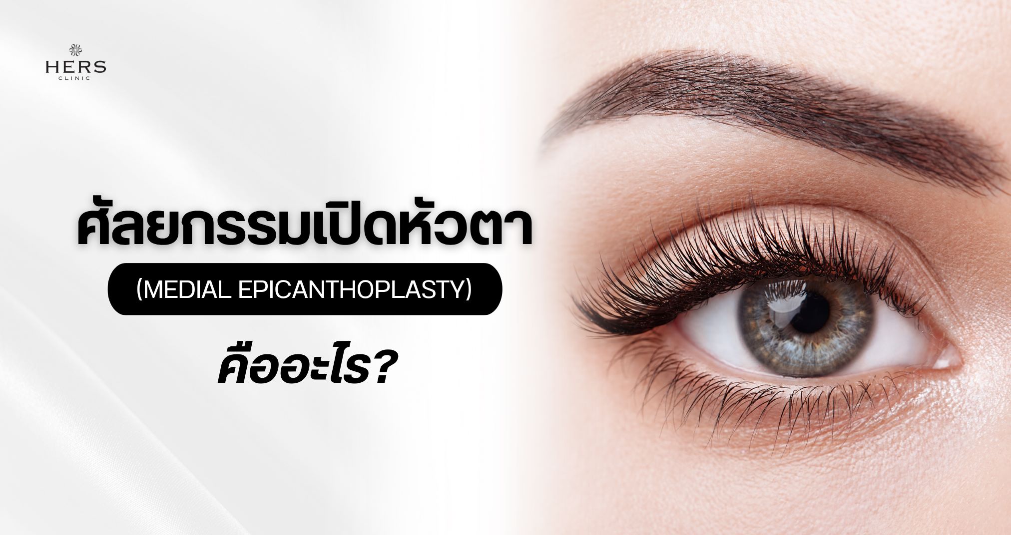 ศัลยกรรม เปิดหัวตา (Medial Epicanthoplasty)