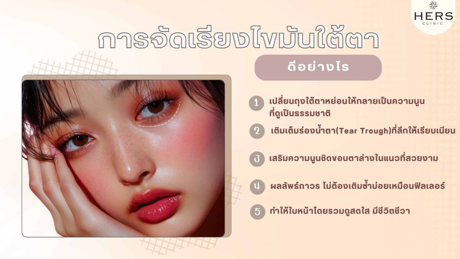 การจัดไขมันใต้ตาเพื่อสร้าง"ดอลลี่อาย"