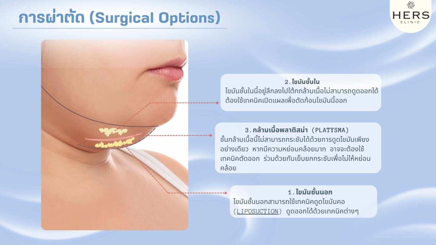 การผ่าตัดรักษา คอเป็นรอยพับ คอเหี่ยว