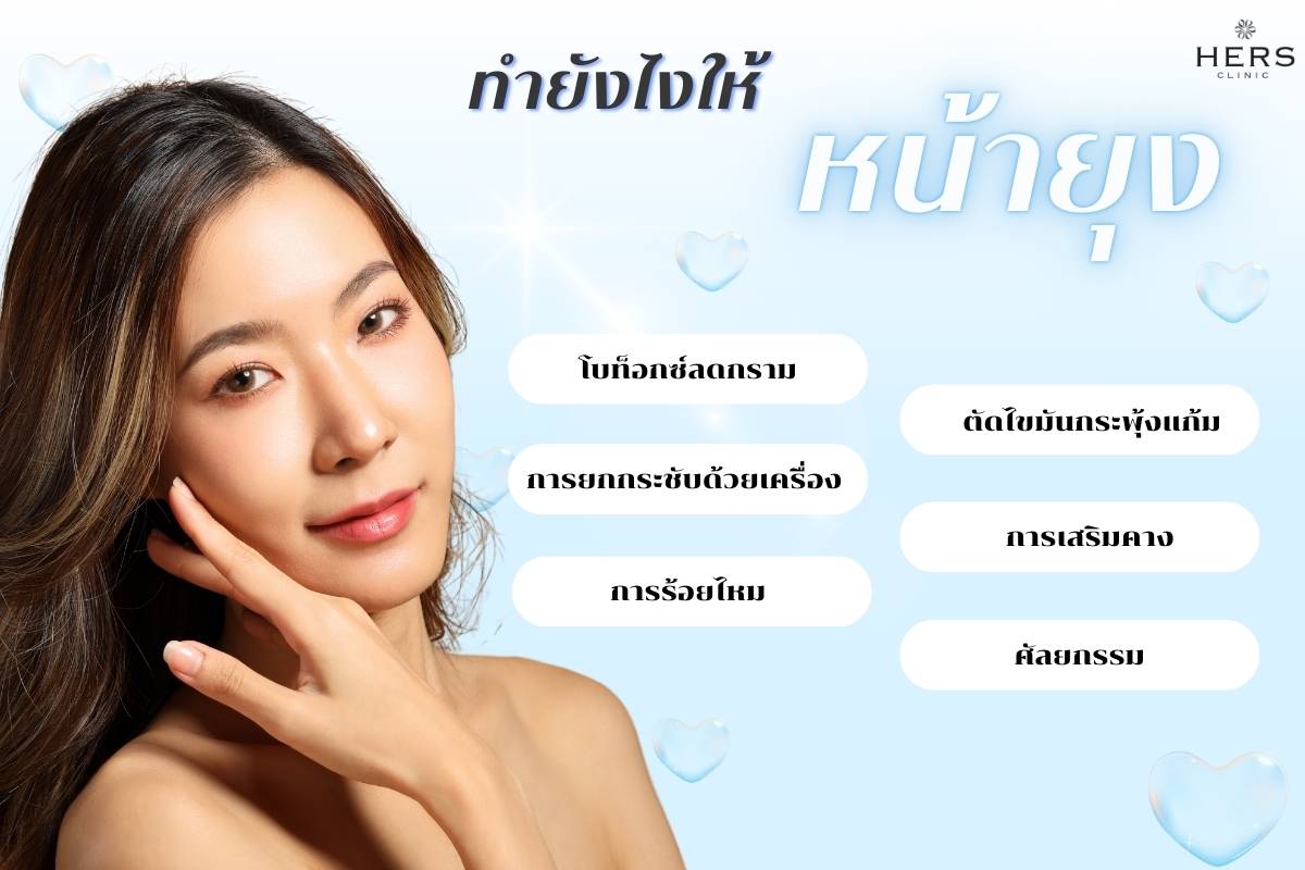 ทำยังไงให้หน้ายุง