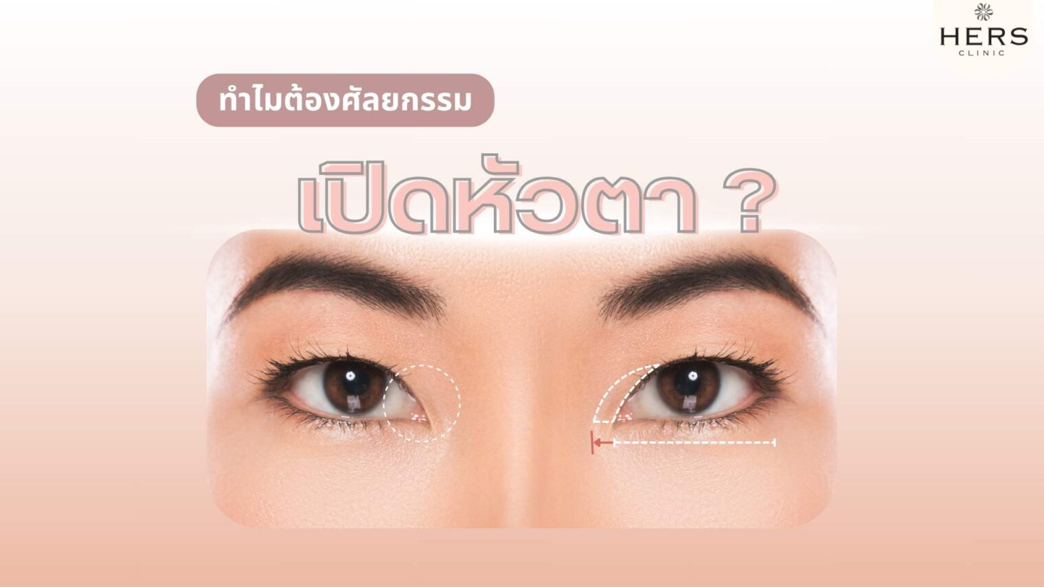 ทำไมต้องศัลยกรรม เปิดหัวตา