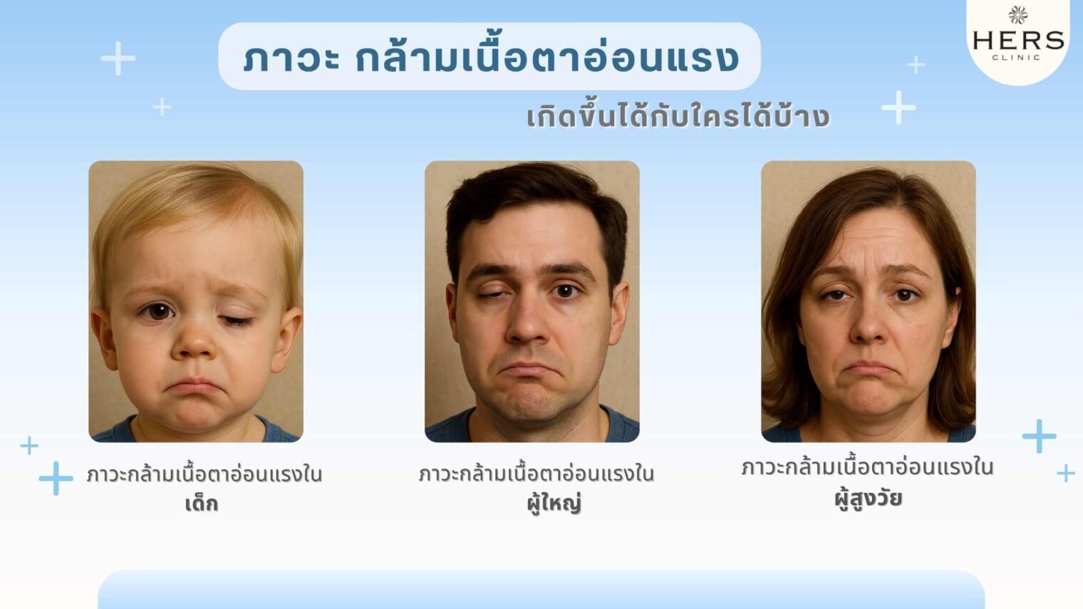 กล้ามเนื้อตาอ่อนแรง เกิดขึ้นได้กับใครบ้าง