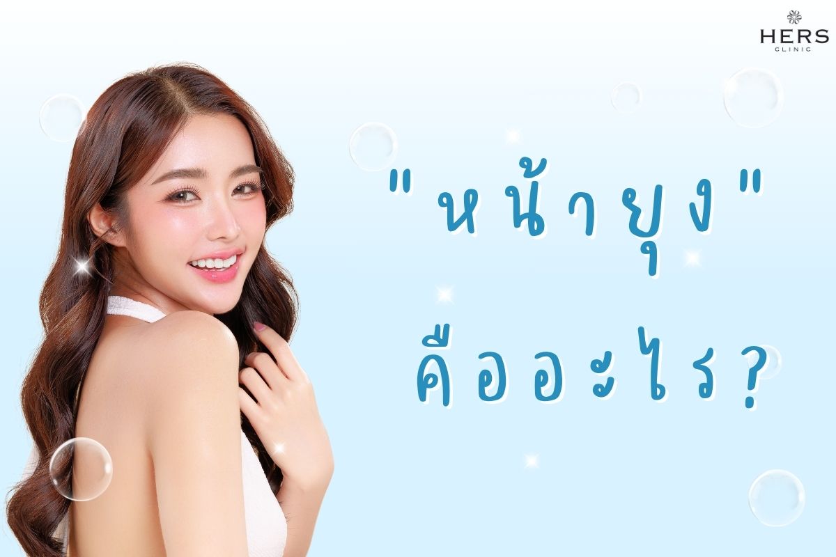 หน้ายุงคืออะไร
