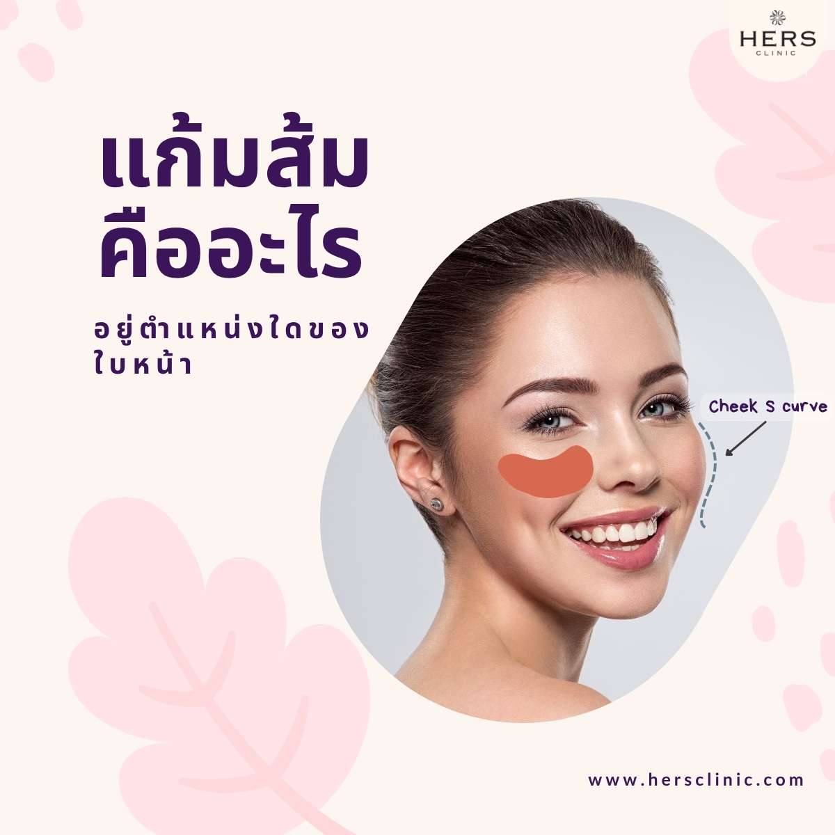 แก้มส้ม คืออะไร อยู่ตำแหน่งใดของใบหน้า