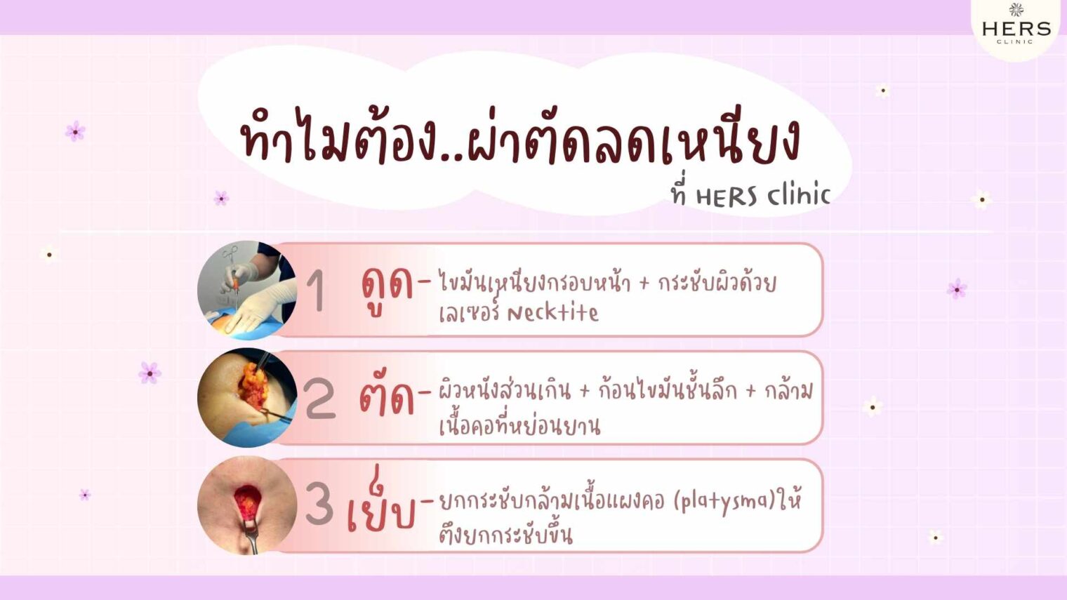 ทำไม..ต้องผ่าตัดลดเหนียงที่ HERS Clinic