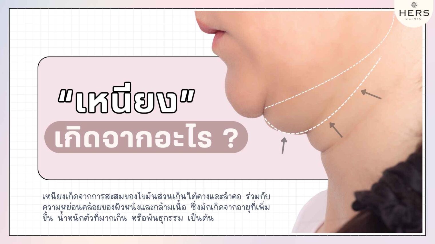 “เหนียง” เกิดจากอะไร