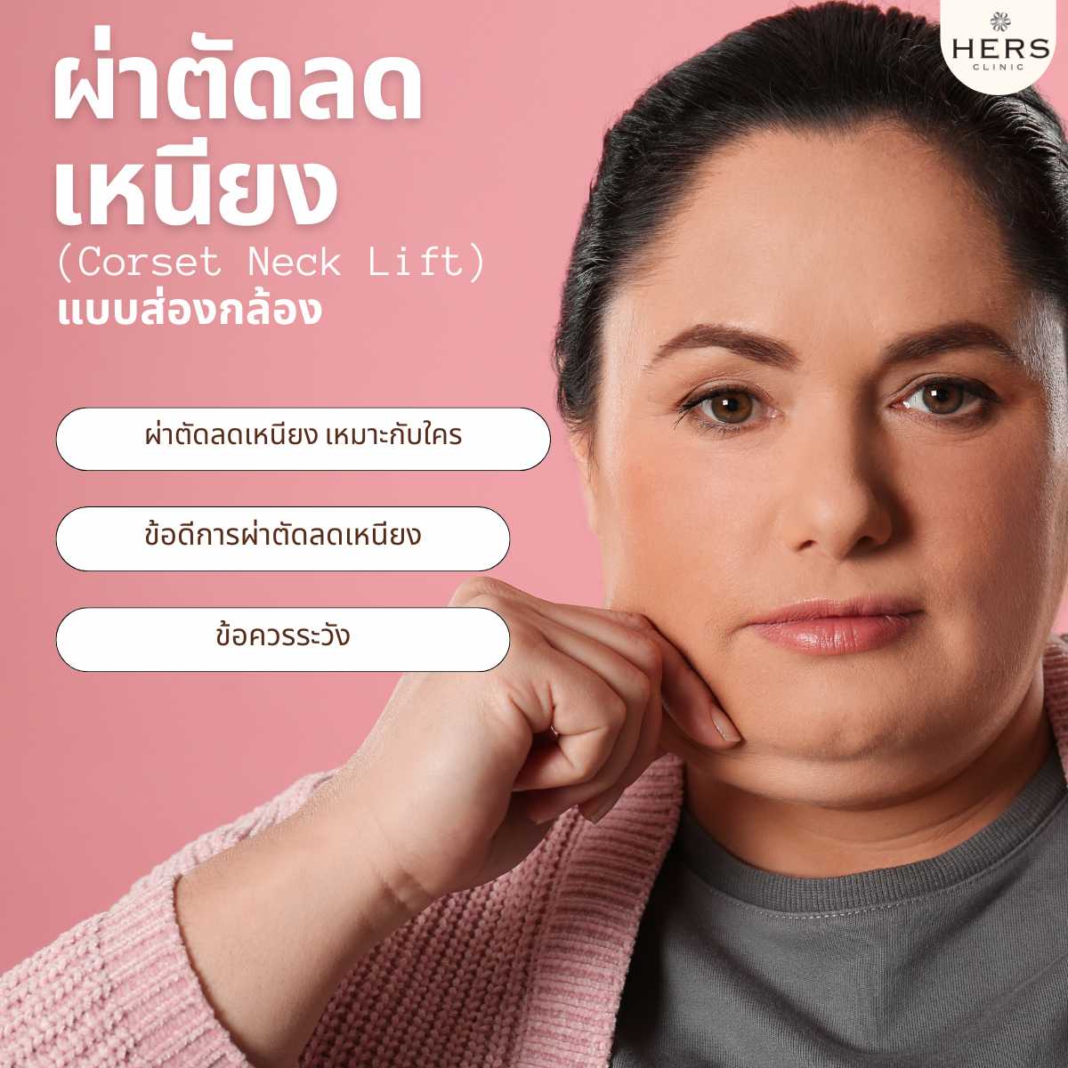 ผ่าตัดลดเหนียงโปรแกรม Corset Neck Lift แบบส่องกล้อง