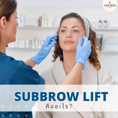 subbrow lift คืออะไร
