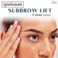 subbrow lift