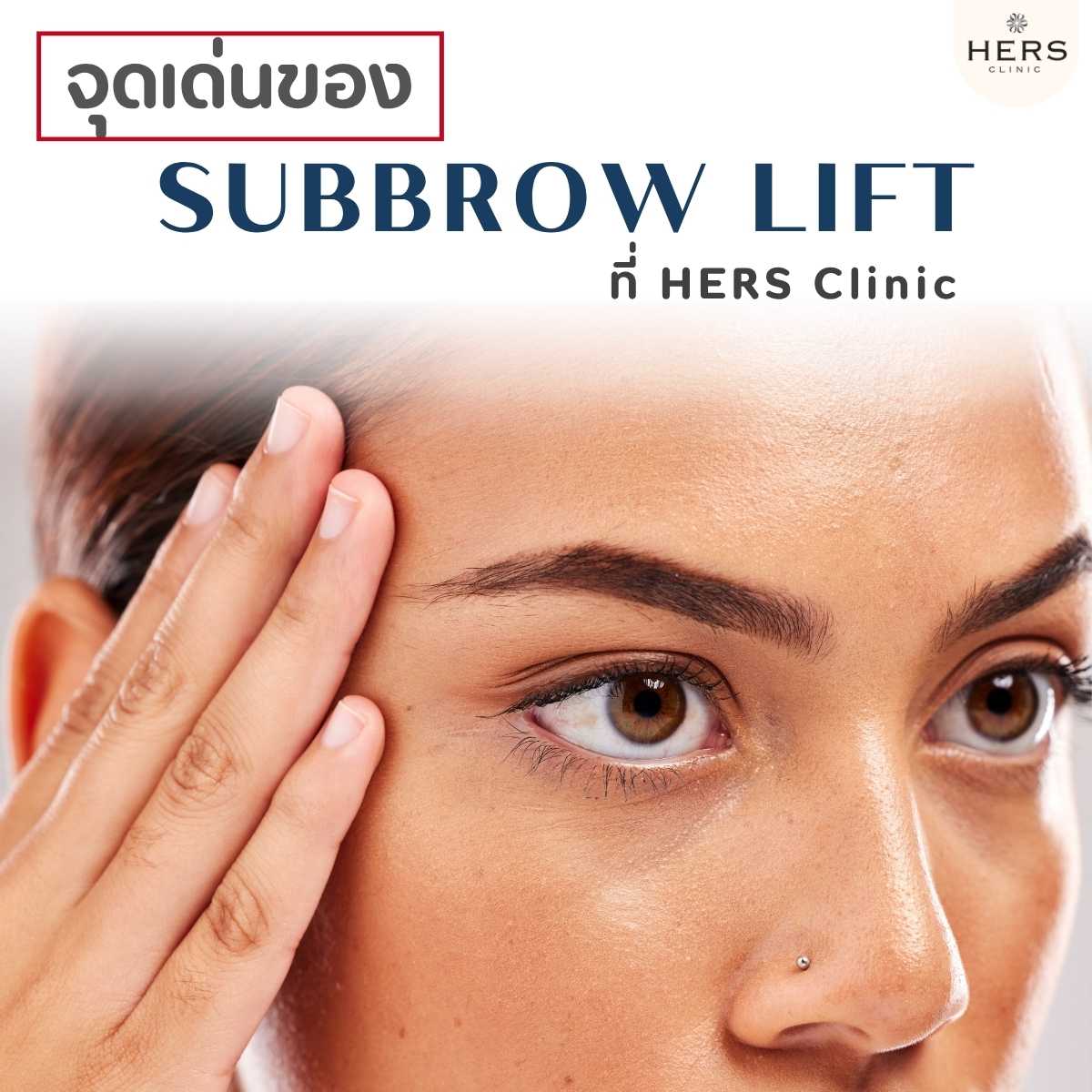 จุดเด่นของ Subbrow Lift ที่ HERS Clinic