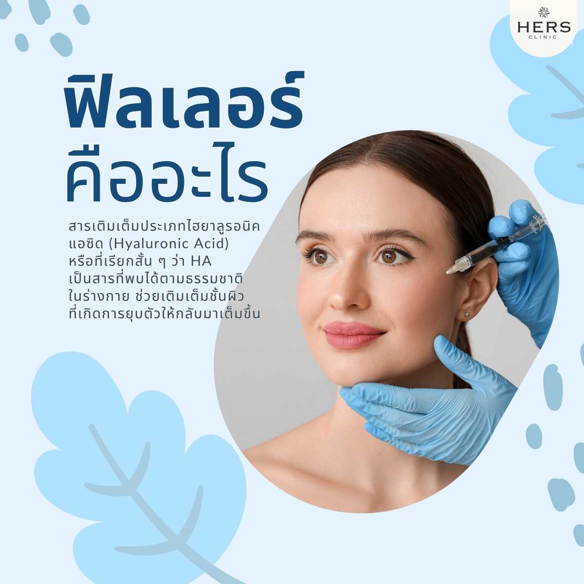 ฟิลเลอร์ คืออะไร?