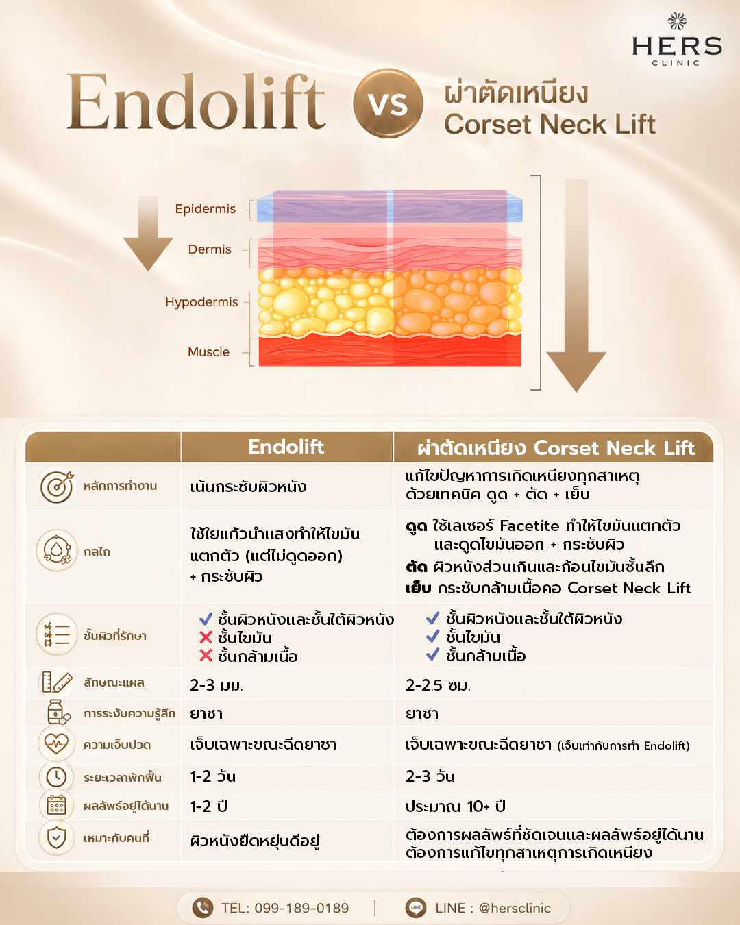 ผ่าตัดเหนียง และโปรแกรม Endolift